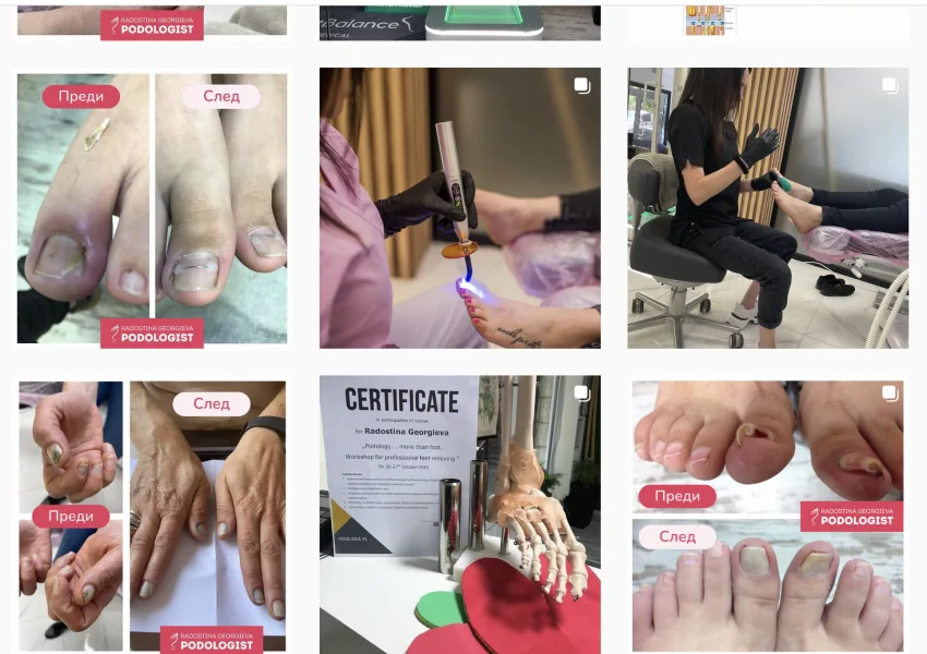 Podo centre Instagram posts: before-and-after photos and work in the practice